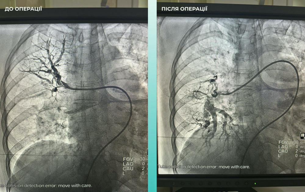 9957 image for slide