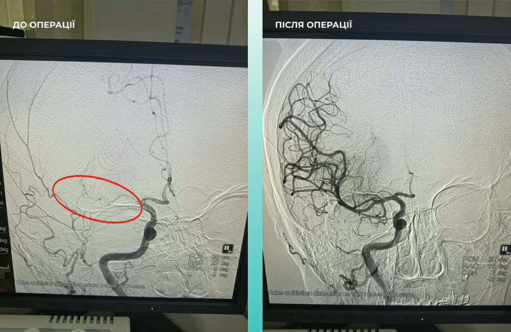 9958 image for slide